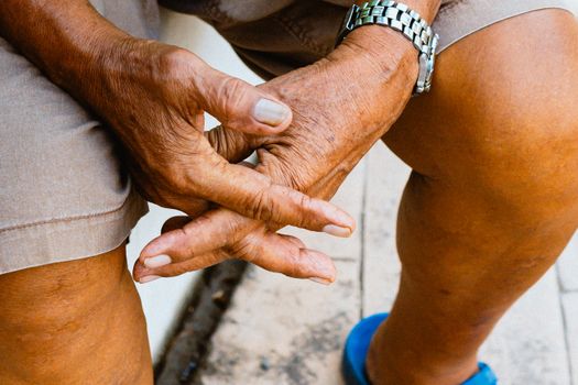 cellular senescence vs aging - Cellular senescence vs aging: why the distinction matters