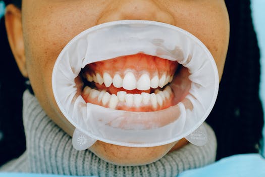 oral microbiome how it works biofilm - Why biofilm is hard to remove: matrix, adhesion, and gradients